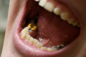 Teeth