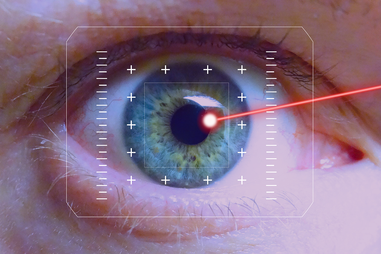 laser surgery